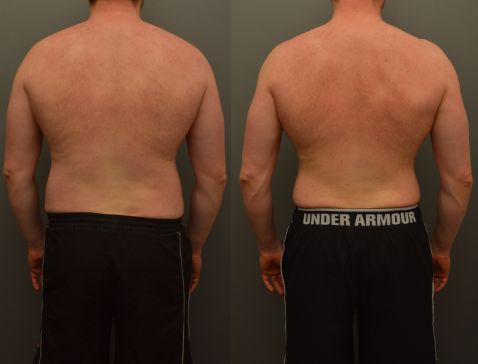 20170516_Phillipp Hass Back.png